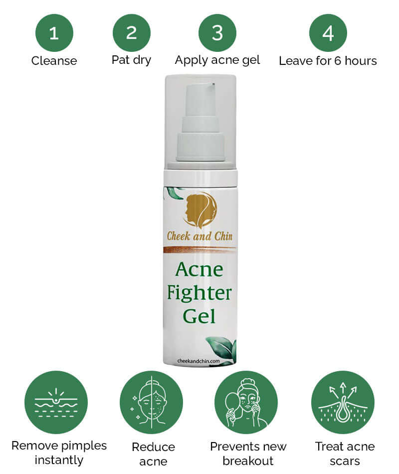 Cheek and Chin Acne Fighter Gel